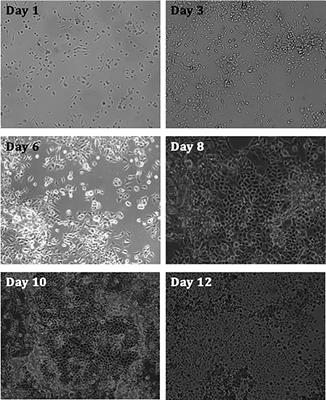 Pleural Fluid Has Pro-Growth Biological Properties Which Enable Cancer Cell Proliferation